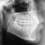 Radiologia Odontológica em São José - SC